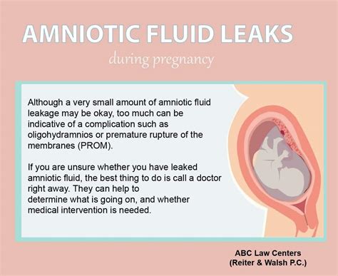 how to tell if your leaking amniotic fluid|Signs Of Leaking Amniotic Fluid Vs. Discharge: The Difference